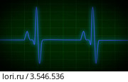 Электрокардиограмма EKG. Стоковая анимация, аниматор Александр Дейнега / Фотобанк Лори