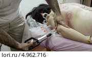 Врач ставит вакуумные банки женщине для снятия болей в предплечье. Стоковое видео, видеограф verbaska / Фотобанк Лори