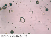 Toxocara canis и эмбриональные яйца с личинками. Стоковое фото, фотограф Руднева Ольга / Фотобанк Лори