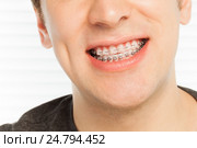 Happy man's smile with orthodontic cases. Стоковое фото, фотограф Сергей Новиков / Фотобанк Лори