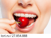 Woman with dental braces biting off ripe cherry. Стоковое фото, фотограф Сергей Новиков / Фотобанк Лори