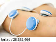 Electro stimulation in physical therapy to a young woman leg. Стоковое фото, фотограф Javier Sánchez Mingorance / Ingram Publishing / Фотобанк Лори