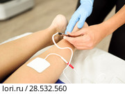 Electroacupuncture dry with needle on female ankle. Стоковое фото, фотограф Javier Sánchez Mingorance / Ingram Publishing / Фотобанк Лори