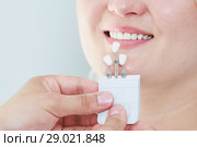 dentistry. matching colour of the tooth enamel with whitening chart. Стоковое фото, фотограф Дмитрий Калиновский / Фотобанк Лори