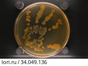 Petri dish with a colony of bacteria on a dirty hand. Стоковое фото, фотограф Irina Kuchugurina/Gaudy / Фотобанк Лори