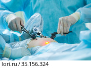 Laparoscopy. Doctor's hands with laporoscopic tools during operation. Стоковое фото, фотограф Дмитрий Калиновский / Фотобанк Лори