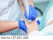 Laser cosmetic surgery and skin resurfacing in dermatology. Стоковое фото, фотограф Дмитрий Калиновский / Фотобанк Лори