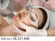 Therapist beautician makes a laser rejuvenation for the model by apparatus in a beauty salon. Стоковое фото, фотограф Юлия Тарасова / Фотобанк Лори