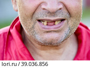 Toothless Caucasian middle aged man, lower part of face close up. Стоковое фото, фотограф Владимир Григорьев / Фотобанк Лори