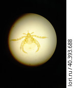 Ixodid tick under a microscope. Стоковое фото, фотограф Egor Sarantstv / Фотобанк Лори