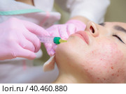 The doctor gives injections of blood plasma into the face of a young girl. Стоковое фото, фотограф Юрий Поздников / Фотобанк Лори