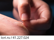 Women's fingers pierce a callus on the heel with a needle. Стоковое фото, фотограф Воловодов Владимир / Фотобанк Лори