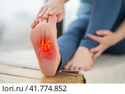 Joint diseases, hallux valgus, plantar fasciitis, heel spur, woman's leg hurts, pain in the foot, massage of female feet at home. Стоковое фото, фотограф Станислав Тарко / Фотобанк Лори