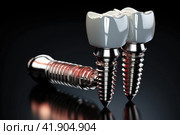 Tooth implant and teeth on a black background. Стоковое AI-изображение, AI-художник Ирина Михайличенко / Фотобанк Лори