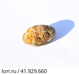 Stone of gallbladder. The result of gallstones. A calculus of heterogeneous composition. Стоковое фото, фотограф Леонид Еремейчук / Фотобанк Лори