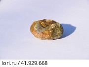 Stone of gallbladder. The result of gallstones. A calculus of heterogeneous composition. Стоковое фото, фотограф Леонид Еремейчук / Фотобанк Лори