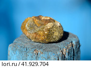 Gall bladder stone. Calculus of heterogeneous composition. Стоковое фото, фотограф Леонид Еремейчук / Фотобанк Лори