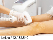 Elos epilation hair removal procedure on a woman body. Beautician doing laser rejuvenation in a beauty salon. Removing unwanted body hair. Hardware ipl cosmetology. Стоковое фото, фотограф Ирина Михайличенко / Фотобанк Лори