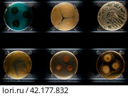 Different types of bacteria, mold and fungi in petri dishes. Стоковое фото, фотограф Irina Kuchugurina/Gaudy / Фотобанк Лори