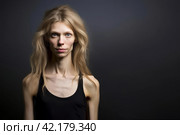 An anorexic woman depressed and tired. Стоковое AI-изображение, AI-художник Irina Kuchugurina/Gaudy / Фотобанк Лори
