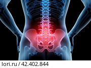 Hip joint pain, lumbar spine hernia, human body with osteoarthritis on a black background, health problems concept, AI Generated. Стоковое AI-изображение, AI-художник Станислав Тарко / Фотобанк Лори
