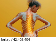 Shoulder-scapular periarthritis, shoulder blades, lumbar and neck pain, intervertebral spine hernia, woman with back pain on yellow background, spinal disc disease, hip joint arthritis, AI Generated. Стоковое AI-изображение, AI-художник Станислав Тарко / Фотобанк Лори