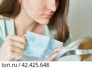 Unknown female teenager with acne taking off medical mask. Стоковое фото, фотограф Natalia Gdovskaia / Фотобанк Лори
