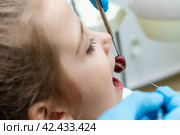 Close up dentist, doctor examines the oral cavity of a little girl, uses a mouth mirror, baby teeth close-up, the concept of pediatric dentistry, dental treatment. Стоковое фото, фотограф Ирина Михайличенко / Фотобанк Лори