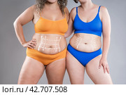 Two overweight women with cellulitis, fat flabby bellies, legs, hands, hips and buttocks on gray background, obese female body, liposuction and plastic surgery concept. Стоковое фото, фотограф Станислав Тарко / Фотобанк Лори