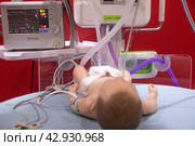 Презентация реанимационного оборудования для оказания медицинской помощи младенцу на выставке-форуме "Россия" на ВДНХ в городе Москве, Россия (2024 год). Редакционное фото, фотограф Николай Винокуров / Фотобанк Лори