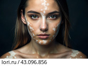 Leukoderma. Vitiligo. Violation of skin pigmentation. Large white spots all over the body and face. Portrait of a beautiful girl with a skin disease. Стоковое AI-изображение, AI-художник Photojuli / Фотобанк Лори