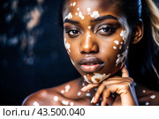 Leukoderma. Vitiligo. Violation of skin pigmentation. Large white spots all over the body and face. Portrait of a beautiful girl with a skin disease. Стоковое AI-изображение, AI-художник Photojuli / Фотобанк Лори