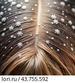 Dandruff problem. A head with itchy head. Стоковое AI-изображение, AI-художник Виктор Застольский / Фотобанк Лори