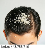 Dandruff problem. A head with itchy head. Стоковое AI-изображение, AI-художник Виктор Застольский / Фотобанк Лори