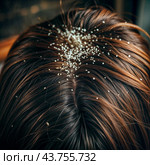 Dandruff problem. A head with itchy head. Стоковое AI-изображение, AI-художник Виктор Застольский / Фотобанк Лори