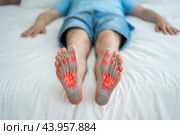 Joint diseases, hallux valgus, plantar fasciitis, man's leg hurts, pain in the foot. Стоковое фото, фотограф Станислав Тарко / Фотобанк Лори