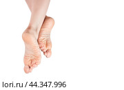 Rough skin on soles of feet. dry heels, dry chapped skin on feet requiring care. Dry and cracked soles of feet. female legs in an elegant position isolated on white background, copy space. Стоковое фото, фотограф Павел Муравьев / Фотобанк Лори