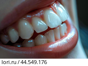 Closeup of healthy white teeth and smile. Стоковое AI-изображение, AI-художник Иван Рябоконь / Фотобанк Лори