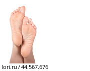 Cracked heel on woman foot. Female feet turned up. Dry heels and soles woman on white background closeup. dry skin on heels and soles needs care. Стоковое фото, фотограф Павел Муравьев / Фотобанк Лори
