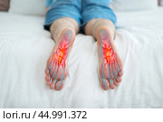 Joint diseases, hallux valgus, plantar fasciitis, man's leg hurts, foot pain. Стоковое фото, фотограф Станислав Тарко / Фотобанк Лори