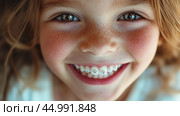 Young girl with braces smiling brightly, showcasing pearly whites and cheerful freckles in a close-up portrait. Стоковое AI-изображение, AI-художник Сергей Толмачёв / Фотобанк Лори