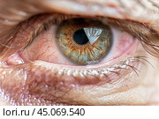 Human Eye with Conjunctivitis extreme close up. Closeup irritated infected red bloodshot eye. Male Eye. Vision. Eyesight. Mature Adult Eye Opening Wide. Viral infection with redness of eyeball. Macro. Стоковое AI-изображение, AI-художник Марина Демидюк / Фотобанк Лори