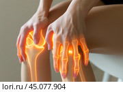 Knee pain, joint inflammation, bone fracture, woman suffering from osteoarthritis, leg injury, arthritis and degenerative changes. Стоковое AI-изображение, AI-художник Станислав Тарко / Фотобанк Лори