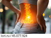 Lumbar intervertebral spine hernia, woman with back pain outdoors, spinal disc disease, health problems concept. Стоковое AI-изображение, AI-художник Станислав Тарко / Фотобанк Лори