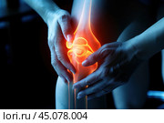 Knee pain, joint inflammation, arthritis and degenerative changes, woman suffering from leg ache and doing self-massage. Стоковое AI-изображение, AI-художник Станислав Тарко / Фотобанк Лори