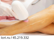 Diode laser epilation hair removal procedure on a woman leg. Beautician doing laser rejuvenation in a beauty salon. Removing unwanted body hair. Hardware cosmetology. High quality photo. Стоковое фото, фотограф Ирина Михайличенко / Фотобанк Лори