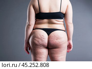 Fat female body with cellulite, overweight back, hips and buttocks. Стоковое фото, фотограф Станислав Тарко / Фотобанк Лори