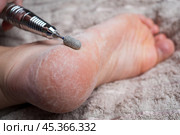 Hardware pedicure for yourself, chiropody and podology concept, foot care. Стоковое фото, фотограф Станислав Тарко / Фотобанк Лори