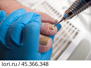 Professional hardware pedicure, ingrown toenail, elderly woman with cracked skin on her foot at a podiatrist's appointment, chiropody and podology concept. Стоковое фото, фотограф Станислав Тарко / Фотобанк Лори
