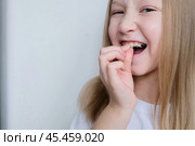 Детская зубная пластина радужного цвета. Ребенок держит в руках ортодонтическую пластинку, чтобы выровнять зубы и расширить челюсть. Стоковое фото, фотограф Терехова Марина / Фотобанк Лори